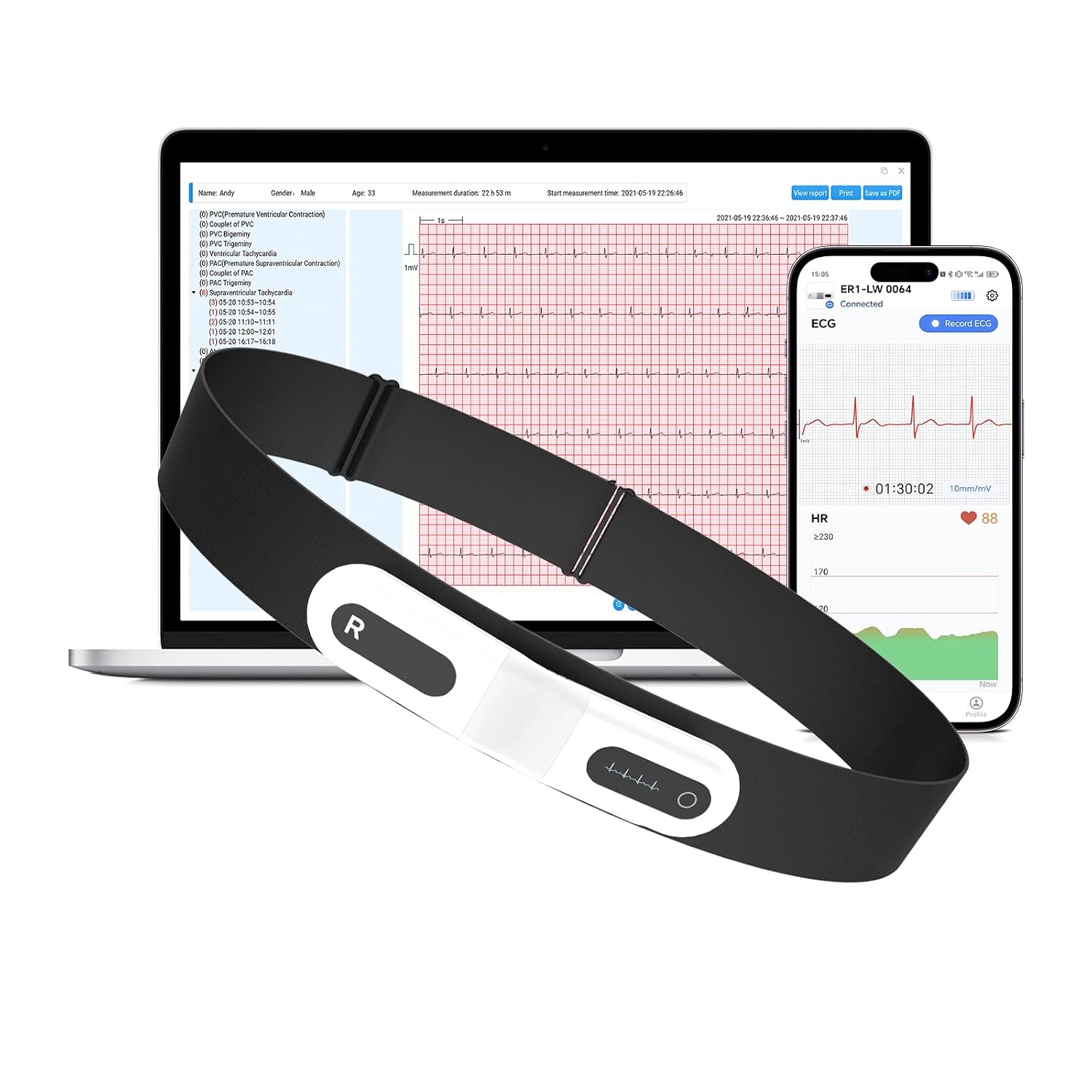 مانیتور هولتر (دستگاه نوار قلب) ECG برند CheckMe مدل ER1-LW (۷۲ ساعته)
