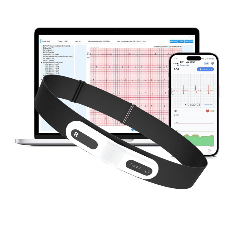 مانیتور هولتر (دستگاه نوار قلب) ECG برند CheckMe مدل ER1-LW (۷۲ ساعته)
