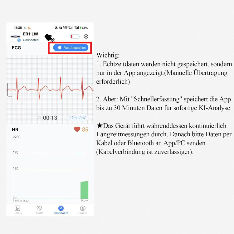 مانیتور هولتر (دستگاه نوار قلب) ECG برند CheckMe مدل ER1-LW (۷۲ ساعته)
