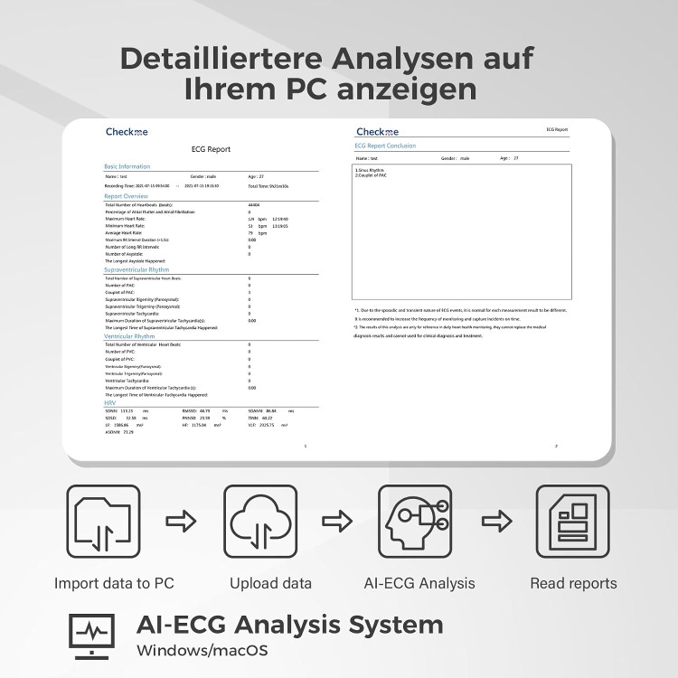 مانیتور هولتر (دستگاه نوار قلب) ECG برند CheckMe مدل ER1-LW (۷۲ ساعته)