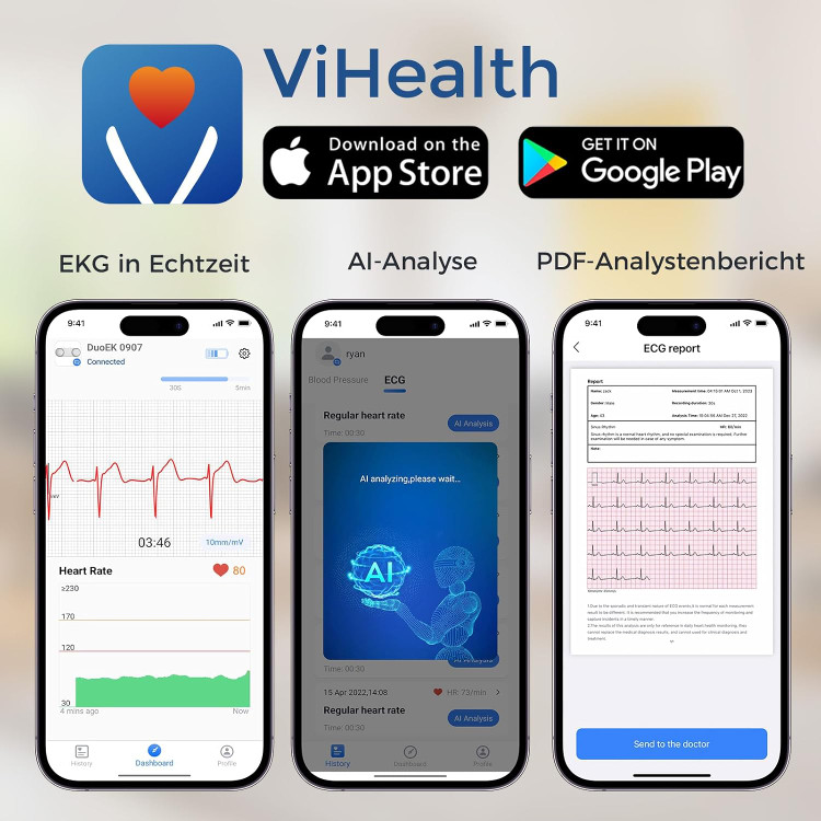 مانیتور هولتر (دستگاه نوار قلب) ECG برند CheckMe مدل ER1-LW (۷۲ ساعته)