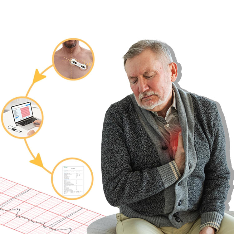مانیتور هولتر (دستگاه نوار قلب) ECG برند CheckMe مدل ER1-LW (۷۲ ساعته)