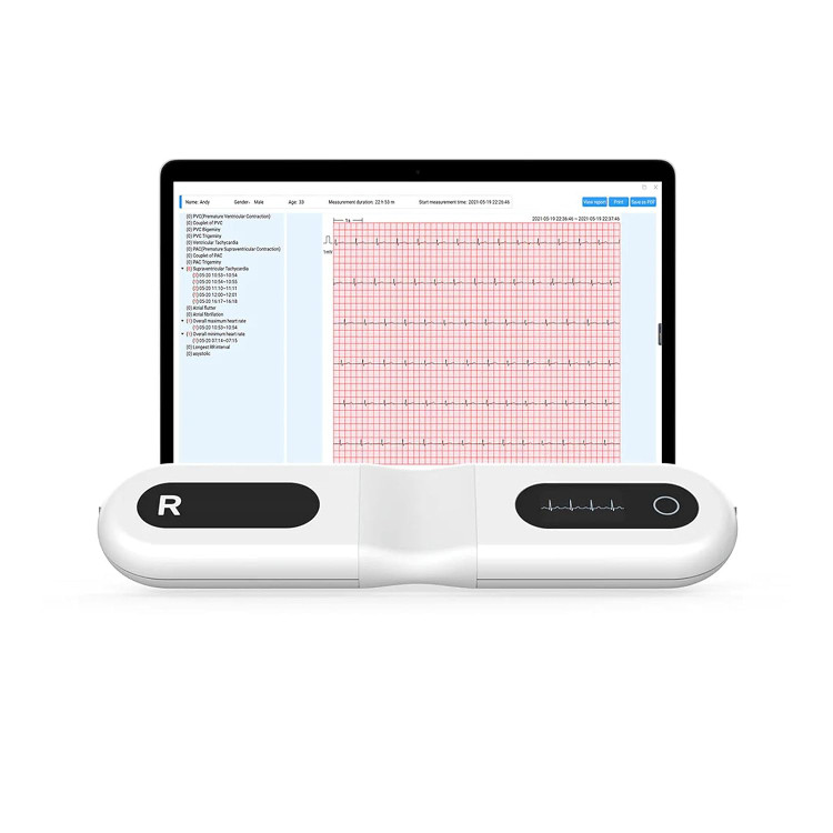 مانیتور هولتر (دستگاه نوار قلب) ECG برند CheckMe مدل ER1-LW (۷۲ ساعته)