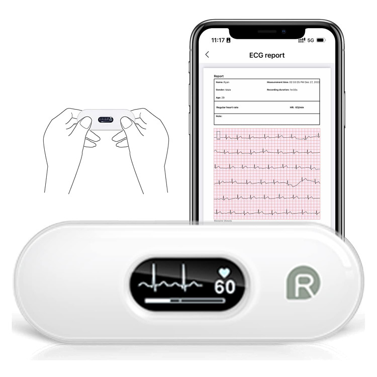 مانیتور نوار قلب (ECG) برند CheckMe مدل DuoEK-S ER2-S (قابلحمل)