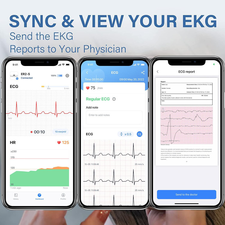 مانیتور نوار قلب (ECG) برند CheckMe مدل DuoEK-S ER2-S (قابلحمل)